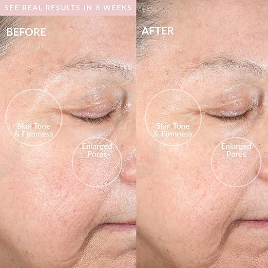 PMD Clean Pro – Cepillo Facial Eléctrico con Tecnología de Calor Activo (Condición: Grado A)